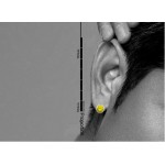 Round Yellow Titanium Earrings 
