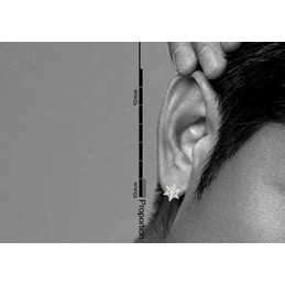 White Snowflake-shaped Titanium Earrings