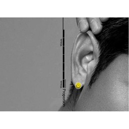 Round Yellow Titanium Earrings 